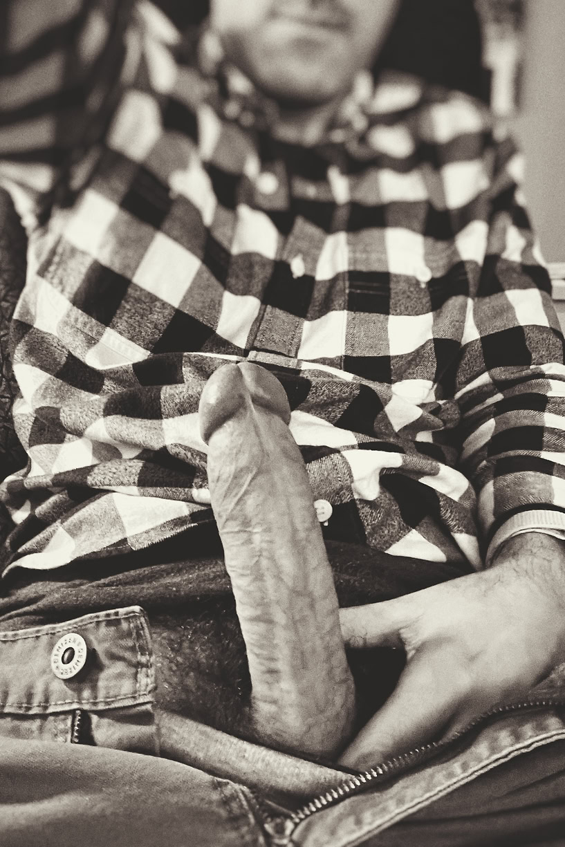 Erect penis and frenular delta seen from below